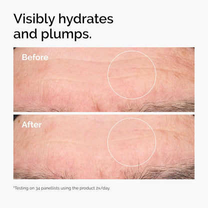 The Ordinary Hyaluronic Acid Serum 2% + B5 30Ml