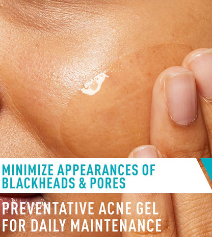 Cerave Acne Control Gel-40ml