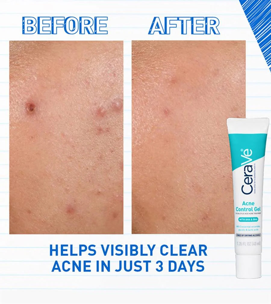 Cerave Acne Control Gel-40ml