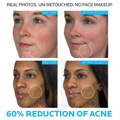 La Roche Posay Effaclar Duo Dual Action Treatment 40ml