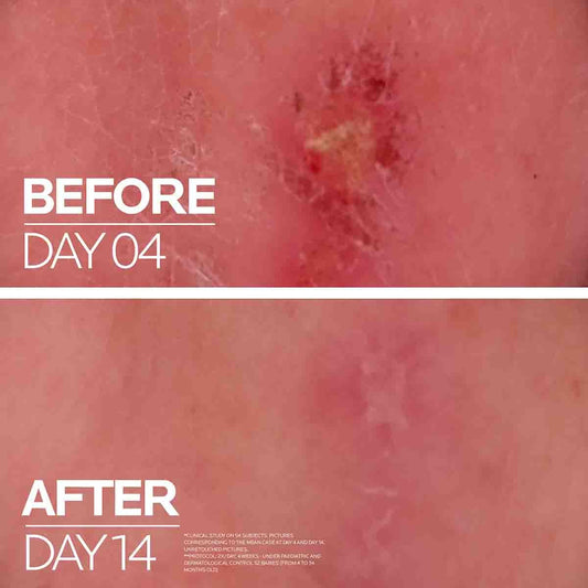 La Roche Posay Cicaplast Baume B5+ Ultra-Repairing Soothing Balm For Irritated Skin 100ml
